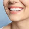 Best Dental Implants in Lahore